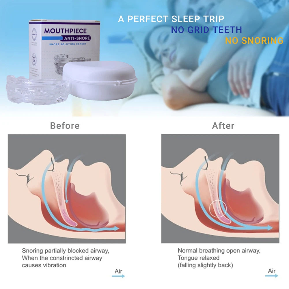 SereneBite Anti-Snoring MouthPeice